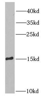 SH2D1A Rabbit Polyclonal Antibody