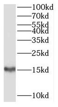SH2D1B Rabbit Polyclonal Antibody