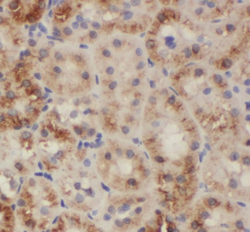 SH2D1B Rabbit Polyclonal Antibody