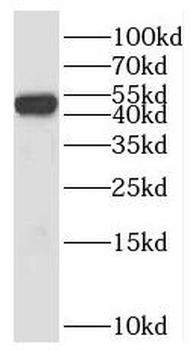 SH2D2A Rabbit Polyclonal Antibody