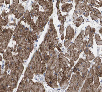 SH2D2A Rabbit Polyclonal Antibody