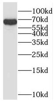 SH2D3A Rabbit Polyclonal Antibody