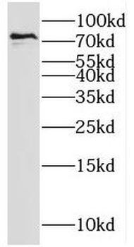 SH2D3C Rabbit Polyclonal Antibody