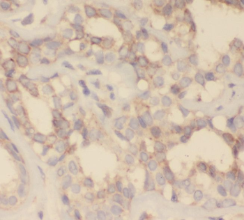 SH2D3C Rabbit Polyclonal Antibody