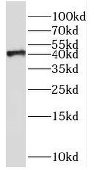 SH3GL3 Rabbit Polyclonal Antibody