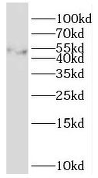 SH3GLB2 Rabbit Polyclonal Antibody