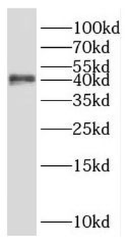 SHARPIN Rabbit Polyclonal Antibody