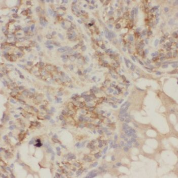 SHARPIN Rabbit Polyclonal Antibody