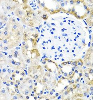 SHMT1 Rabbit Polyclonal Antibody