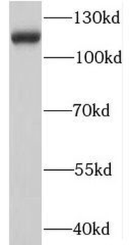 SHROOM1 Rabbit Polyclonal Antibody