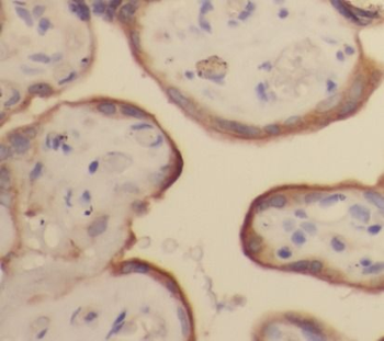 SIGLEC6 Rabbit Polyclonal Antibody
