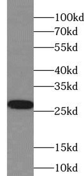 SIGMAR1 Rabbit Polyclonal Antibody