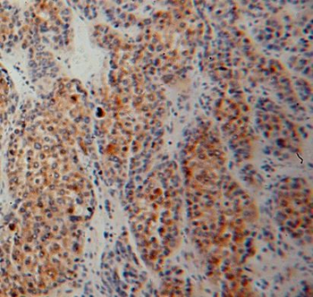 SIGMAR1 Rabbit Polyclonal Antibody