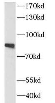 SIK1 Rabbit Polyclonal Antibody