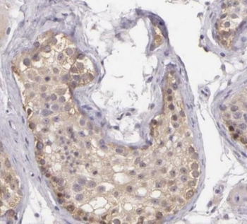 SIK1 Rabbit Polyclonal Antibody