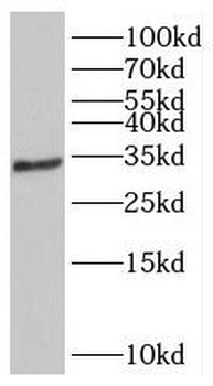 GEMIN2 Rabbit Polyclonal Antibody