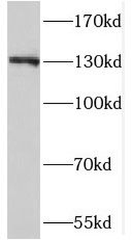 SIPA1 Rabbit Polyclonal Antibody
