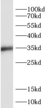 SIX1 Rabbit Polyclonal Antibody