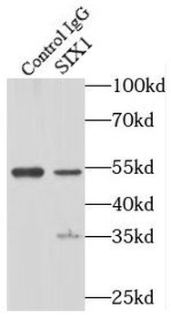 SIX1 Rabbit Polyclonal Antibody