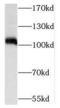 SIX5 Rabbit Polyclonal Antibody