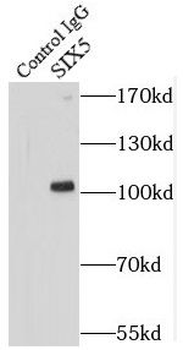 SIX5 Rabbit Polyclonal Antibody