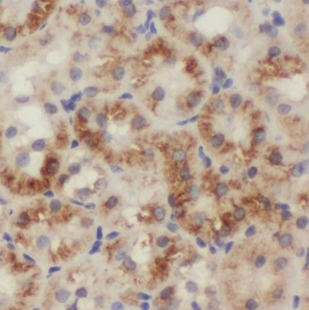 SIX5 Rabbit Polyclonal Antibody