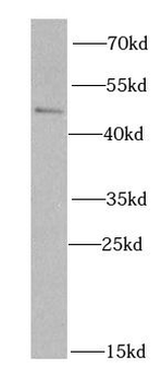 SKAP2 Rabbit Polyclonal Antibody