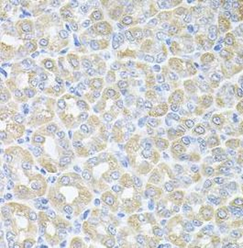SKAP2 Rabbit Polyclonal Antibody