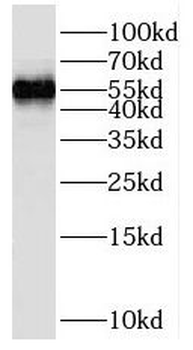 SKAP1 Rabbit Polyclonal Antibody