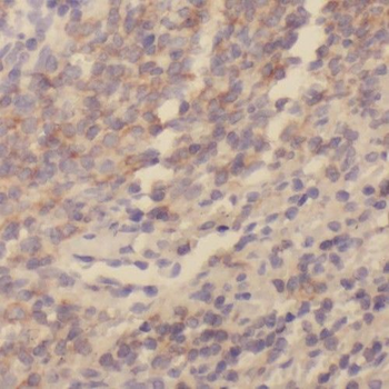 SKAP1 Rabbit Polyclonal Antibody