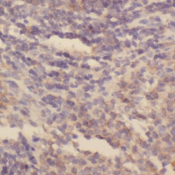 SKAP1 Rabbit Polyclonal Antibody