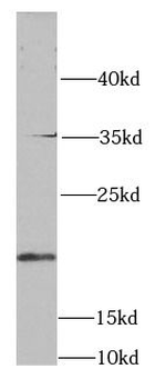 SKP1 Rabbit Polyclonal Antibody