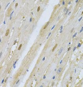 SKP1 Rabbit Polyclonal Antibody