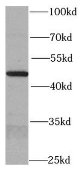 SKP2 Rabbit Polyclonal Antibody