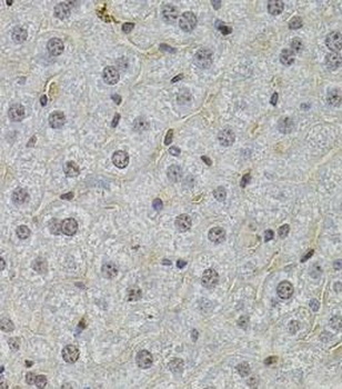 SKP2 Rabbit Polyclonal Antibody