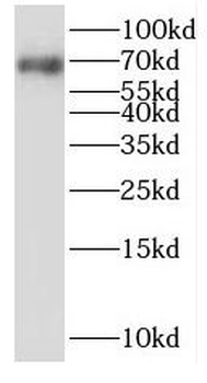 SLC11A2 Rabbit Polyclonal Antibody