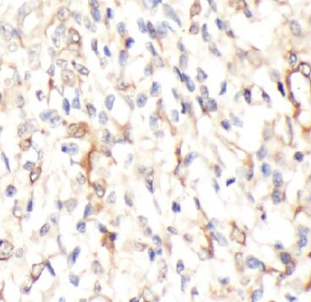 SLC11A2 Rabbit Polyclonal Antibody