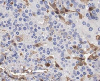 SLC16A3 Rabbit Polyclonal Antibody