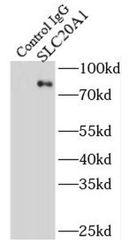 SLC20A1 Rabbit Polyclonal Antibody