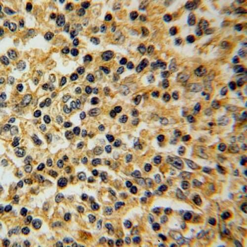 SLC20A1 Rabbit Polyclonal Antibody