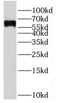 SLC22A15 Rabbit Polyclonal Antibody