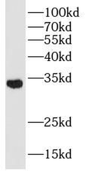 SLC25A1 Rabbit Polyclonal Antibody