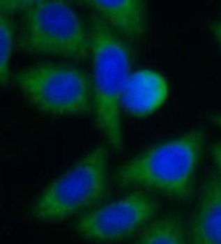SLC25A1 Rabbit Polyclonal Antibody