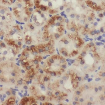 SLC25A1 Rabbit Polyclonal Antibody