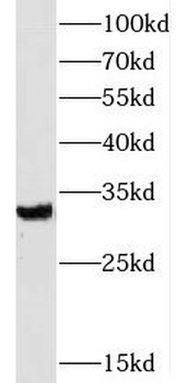 SLC25A18 Rabbit Polyclonal Antibody