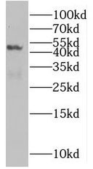 SLC25A24 Rabbit Polyclonal Antibody