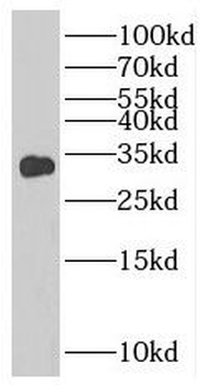 SLC25A4 Rabbit Polyclonal Antibody