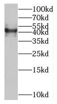 SLC35F2 Rabbit Polyclonal Antibody