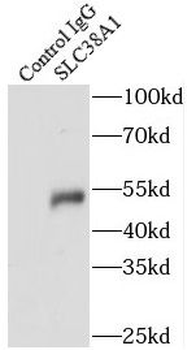 SLC38A1 Rabbit Polyclonal Antibody
