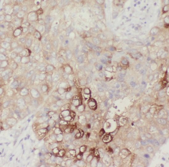 SLC38A3 Rabbit Polyclonal Antibody